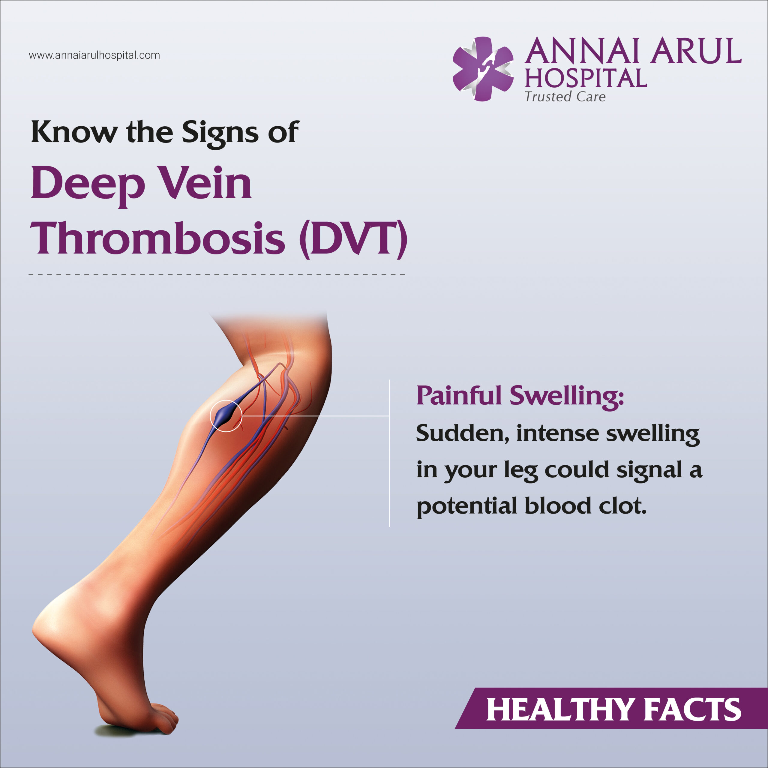 Deep vein thrombosis (DVT) - symptoms, signs and treatment